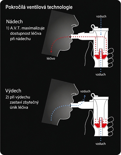 AVT technologie small